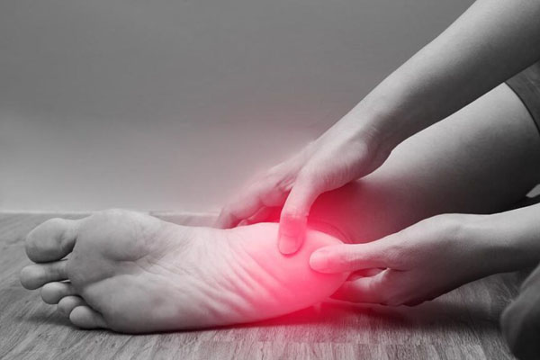 fascite-plantar